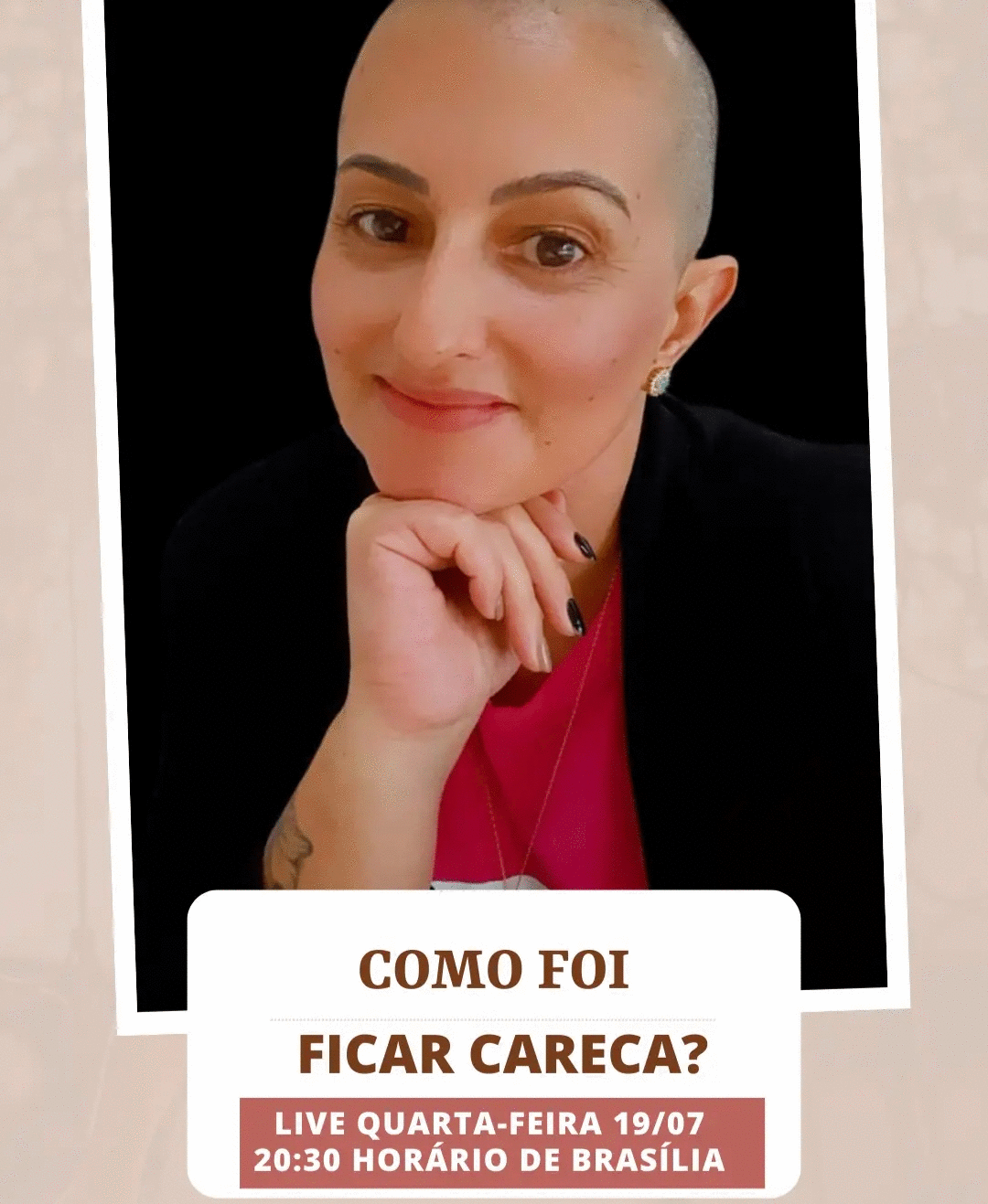 Como foi ficar careca!? 