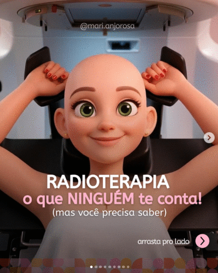 🚨Radioterapia: o que ninguém te conta, mas você precisa saber.