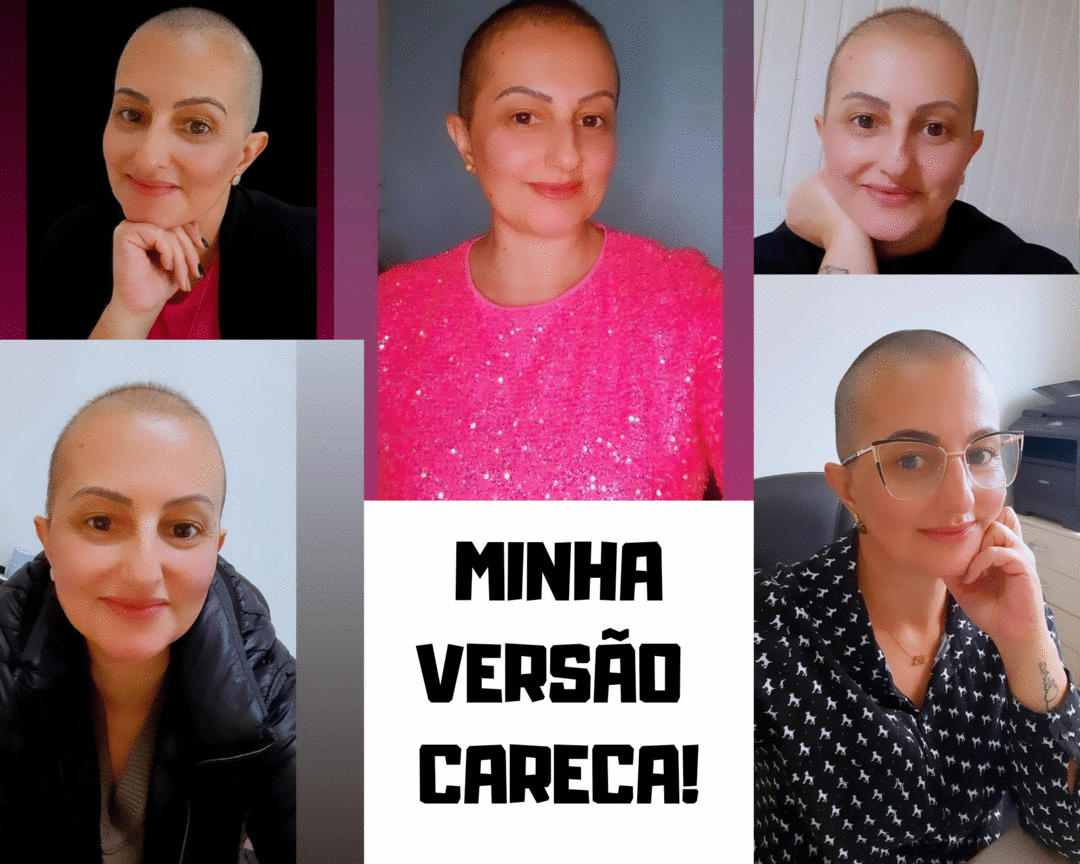 Minha versão careca!